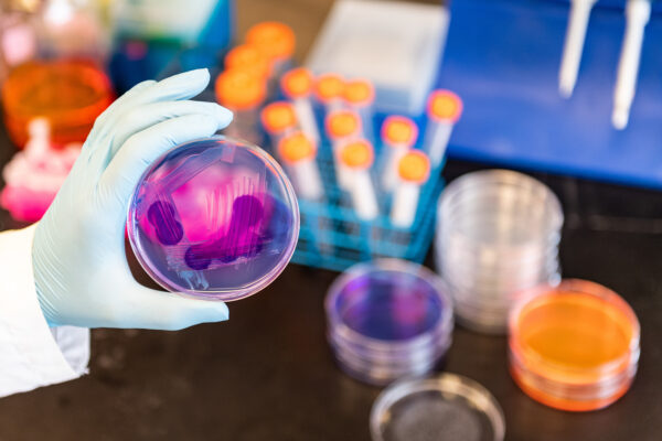 Researcher holds a petri dish